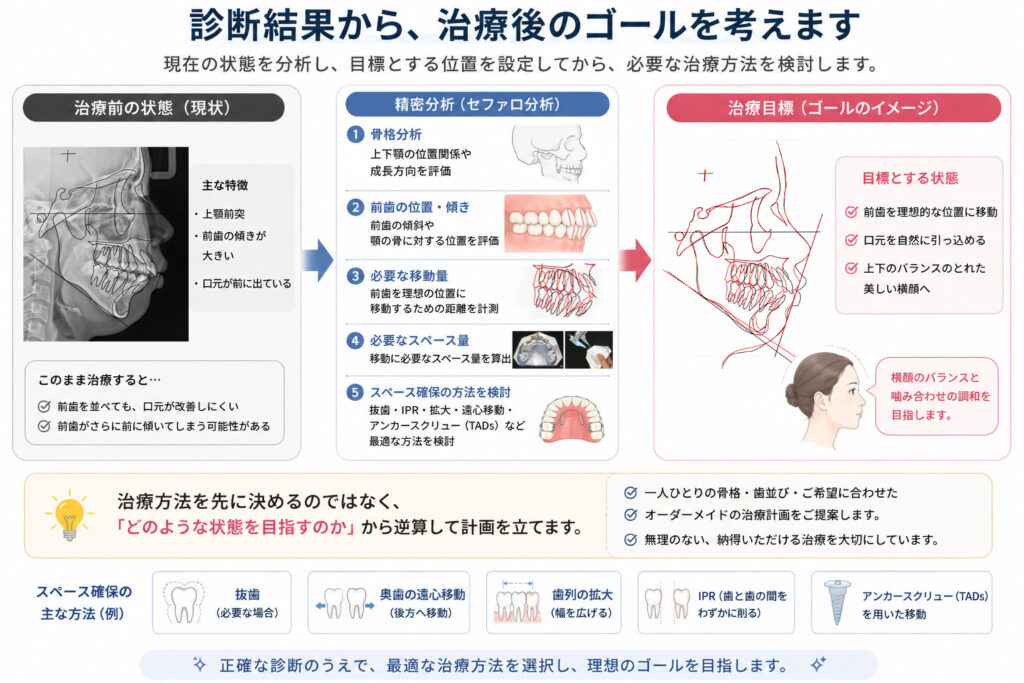 口ゴボの矯正治療シミュレーション