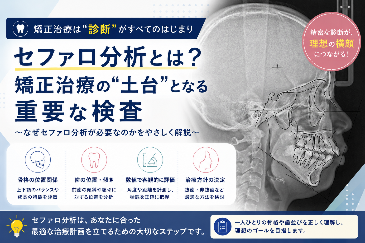 セファロ分析とは？矯正治療の診断で何がわかるの？」を公開しました